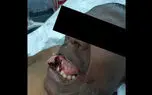 عاقب وحشتناک عامل بی عفت کردن 40 زن / پزشک جوان طاقت نیاورد +عکس