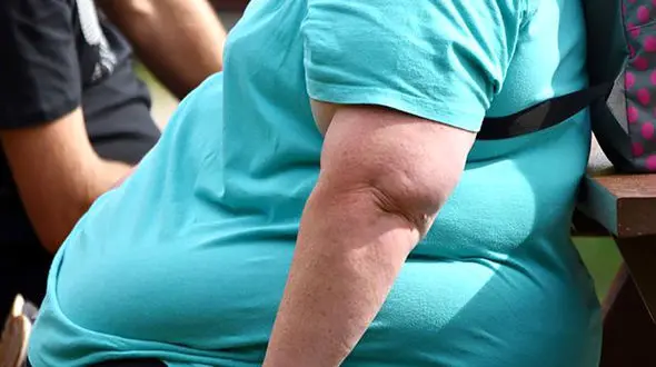  28 در صد مبتلایان به کرونایی اضافه وزن دارند