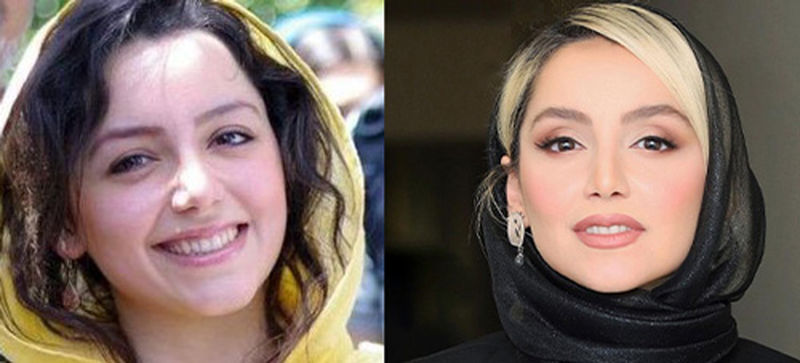 تغییر چهره نازنین بیاتی
