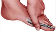 دلایل شایع التهاب مفصلی در انگشتان پا