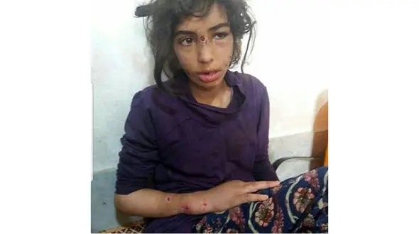 پدر و نامادری شکنجه‌گر کودکان ماهشهری در زندان هستند 