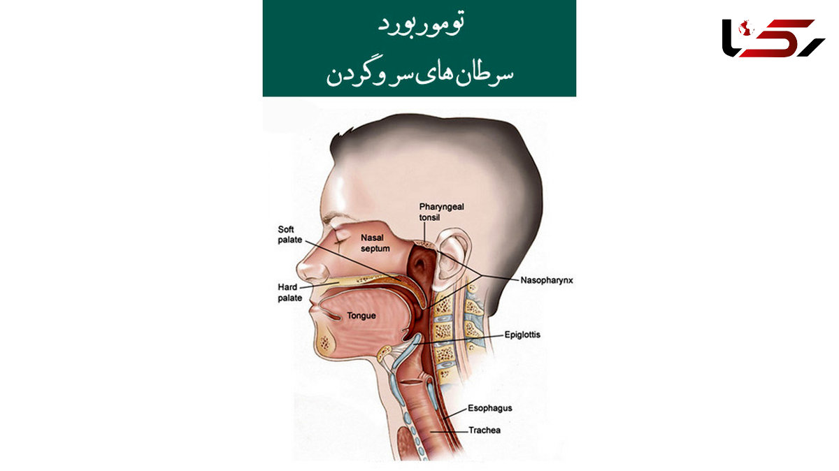 هیچ بیماری برای تشخیص و درمان سرطان به خارج کشور اعزام نمی‌شود