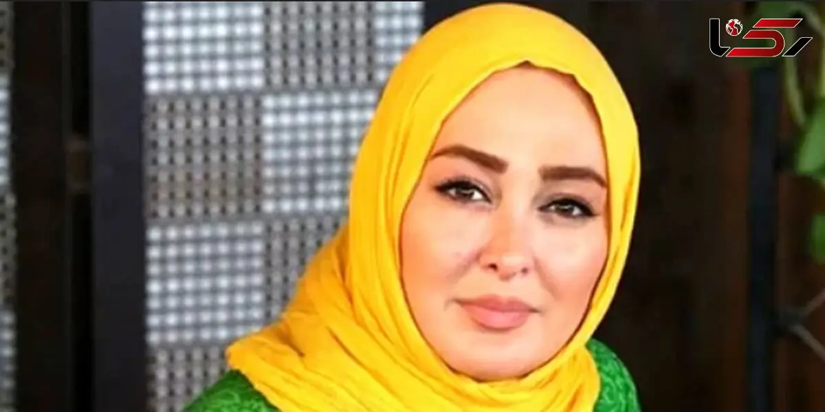 چهره داغون الهام حمیدی  قبل بازیگری ! / چی بود و چطور عروسک شد ! + عکس