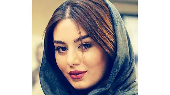 سحر قریشی با دست و پای شکسته و در گچ! + عکس 