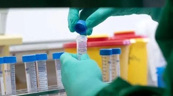 نتیجه مثبت اولیه پلاسما درمانی در اردبیل و تهران + فیلم 