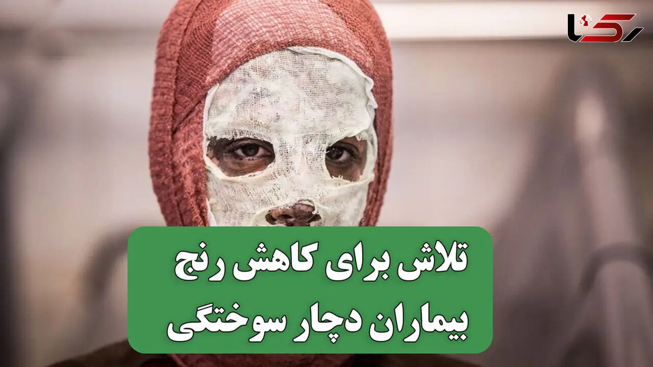 فراتر از یک سوختگی؛ روایت انسان هایی که برای کاهش رنج دیگران می جنگند