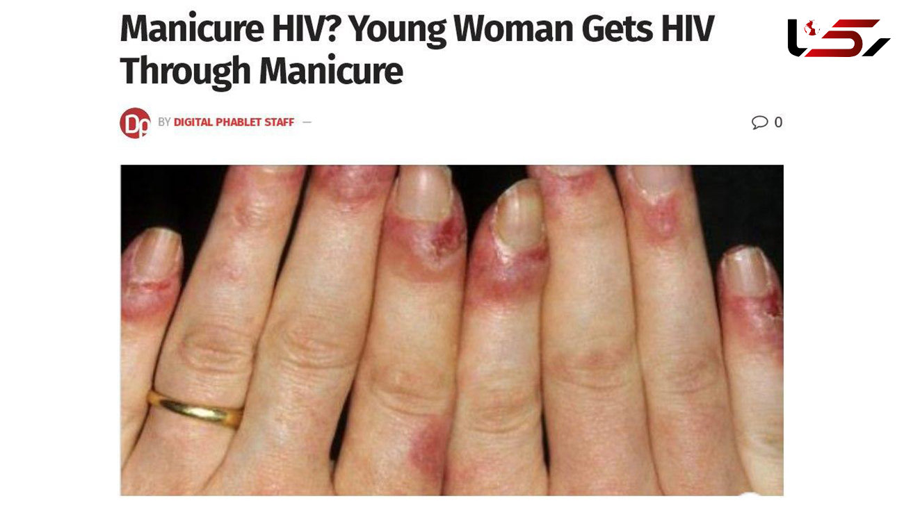 بلای شوم بر سر یک زن در آرایشگاه زنانه / زن جوان ایدز گرفت + عکس