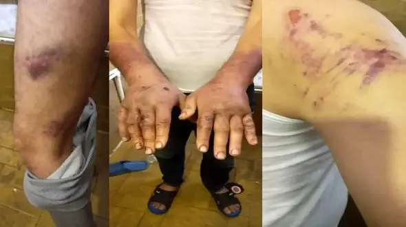 شکنجه پناهجویان افغان به دست مرزبانی ترکیه / پناه آوردن 60 درصد کارمندان و نظامیان دولت قبلی افغانستان به ایران + فیلم 