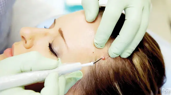 الف تـا ی خال‌برداری