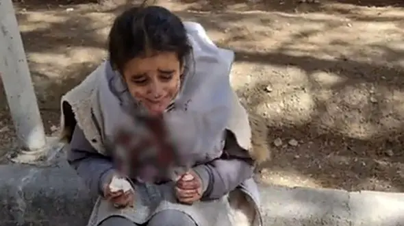 افشای ماجرای کتک خوردن خونین دختر دانش آموز بخاطر بدحجابی / در اصفهان چه اتفاقی افتاده است؟ + عکس