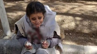 افشای ماجرای کتک خوردن خونین دختر دانش آموز بخاطر بدحجابی / در اصفهان چه اتفاقی افتاده است؟ + عکس