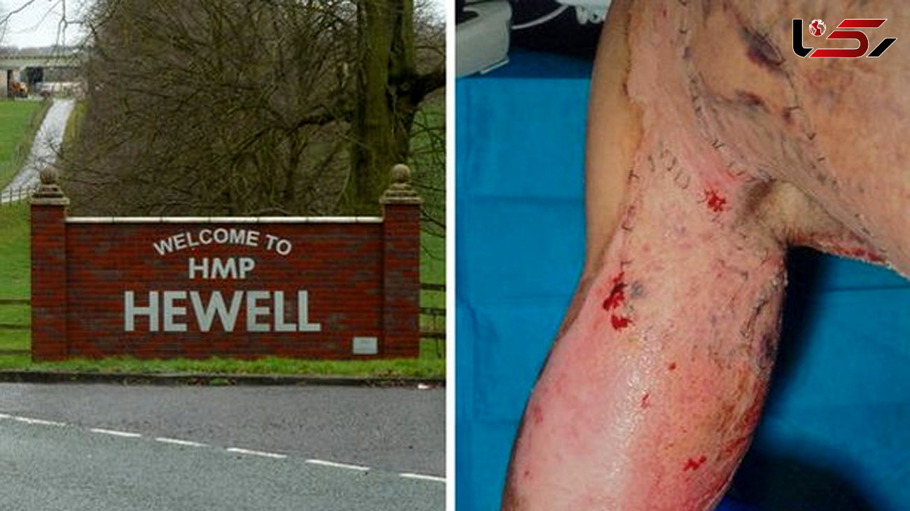 Prison officer hospitalised in 'boiling water and sugar' napalm attack