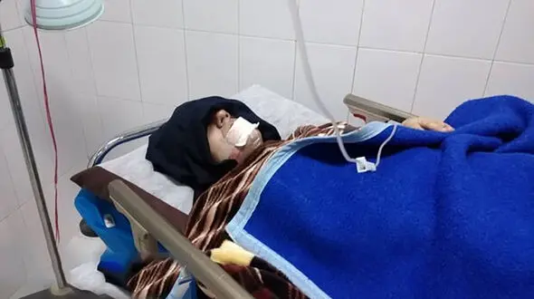 حمله خونین گرگ وحشی به خانم معلم و پیرزن تنها + عکس
