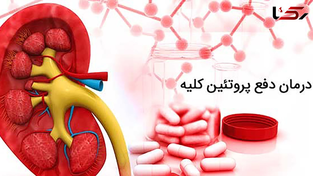 چه چیزی برای رفع دفع پروتئین کلیه خوب است؟