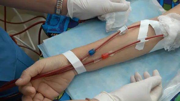 واریز ۱۴۴۶ میلیارد تومان به حساب مراکز دیالیز/ ناترازی بودجه عامل کندی در پرداخت‌ها