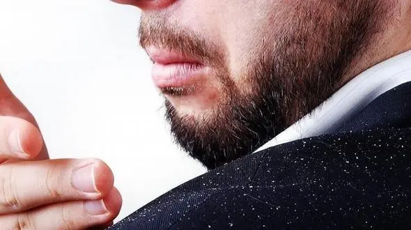 درمان شوره سر با روغن گل سرخ