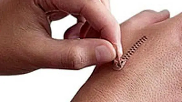 درمان های طبیعی برای از بین بردن جای زخم 