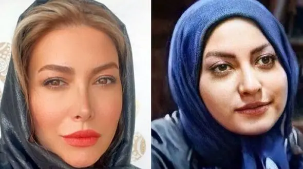 فیلم/ فریبا نادری، پریسیمای سریال «ستایش»: زندگی من به قبل و بعد از عمل بینی تقسیم میشه/ بینی من هم عقابی بود هم کوفته !