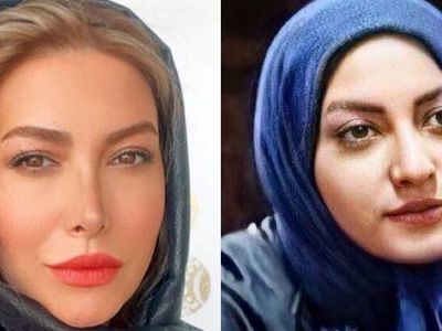 فیلم/ فریبا نادری، پریسیمای سریال «ستایش»: زندگی من به قبل و بعد از عمل بینی تقسیم میشه/ بینی من هم عقابی بود هم کوفته !