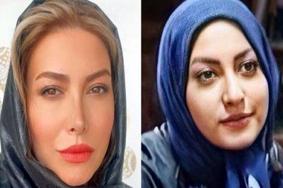 فیلم/ فریبا نادری، پریسیمای سریال «ستایش»: زندگی من به قبل و بعد از عمل بینی تقسیم میشه/ بینی من هم عقابی بود هم کوفته !