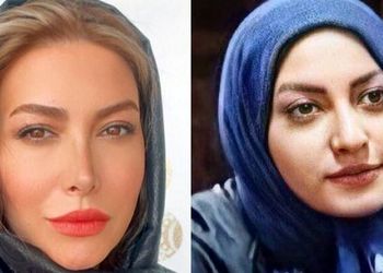 فیلم/ فریبا نادری، پریسیمای سریال «ستایش»: زندگی من به قبل و بعد از عمل بینی تقسیم میشه/ بینی من هم عقابی بود هم کوفته !