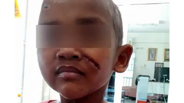 شکنجه تکان دهنده 3 کودک، تایلند را به هم ریخت+عکس