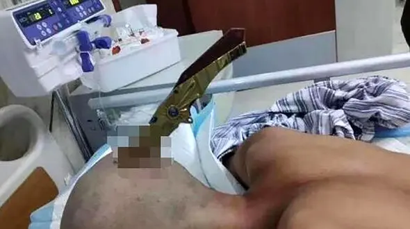 فیلم 16+ / مرد با چاقویی به سر به بیمارستان رفت 