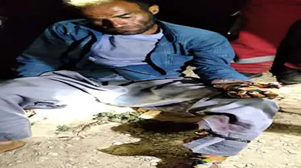 حمله خونین خرس وحشی به عشایر کوهرنگی + عکس 