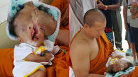 نوزادی عجیب الخلقه در تایلند+عکس(16+)