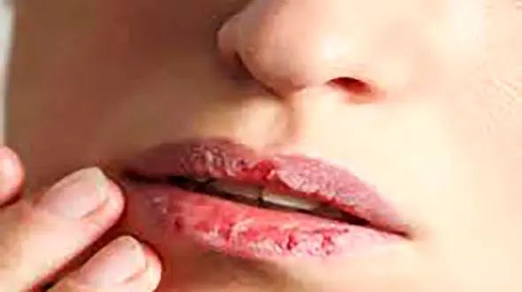 سوال و جواب های مهم درباره لب 