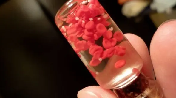 با کمک ژن درمانی بیماری هموفیلی درمان می شود