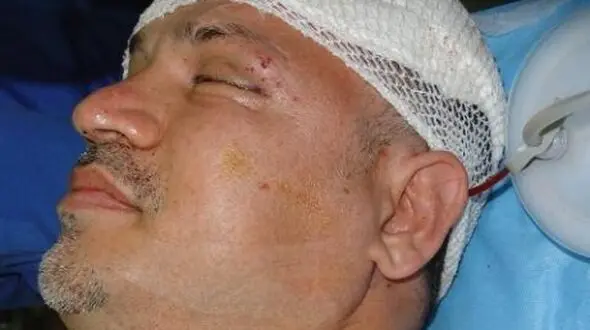 فیلم / نجات معجزه آسای علی دایی از مرگ /  وقتی ماشینم را دیدم گفتم خدایا من چطور زنده ماندم؟ خدا رحم کرد ...