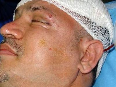فیلم / نجات معجزه آسای علی دایی از مرگ /  وقتی ماشینم را دیدم گفتم خدایا من چطور زنده ماندم؟ خدا رحم کرد ...