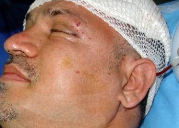 فیلم / نجات معجزه آسای علی دایی از مرگ /  وقتی ماشینم را دیدم گفتم خدایا من چطور زنده ماندم؟ خدا رحم کرد ...