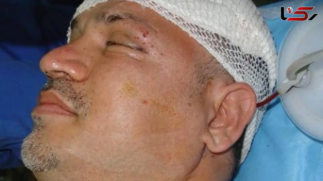 فیلم / نجات معجزه آسای علی دایی از مرگ /  وقتی ماشینم را دیدم گفتم خدایا من چطور زنده ماندم؟ خدا رحم کرد ...