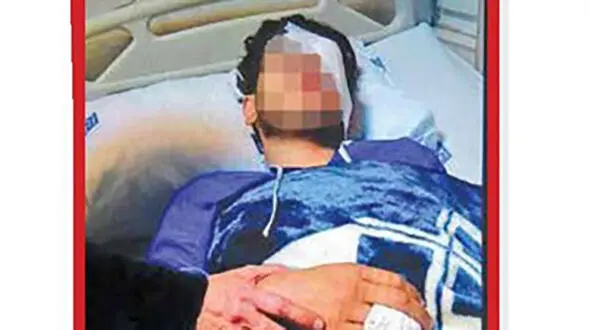 مشت محکم معلم تهرانی باعث کور شدن آرش 18 ساله در مدرسه شد + عکس