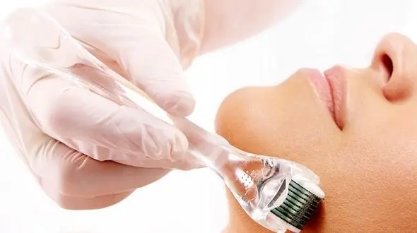 میکرونیدلینگ چیست؟