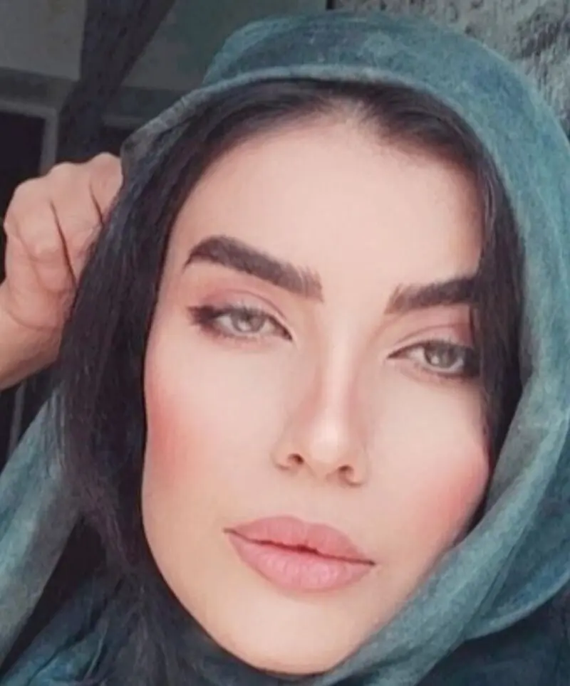 تصویر