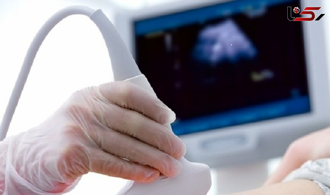 سلامت قلب جنین با سونوگرافی