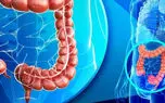 مزایا و روش‌ های مختلف پاکسازی روده