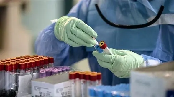 آمار کرونا در ایران تا امروز بیست و نهم مردادماه / ۵۵۵ ایرانی دیگر جانباختند