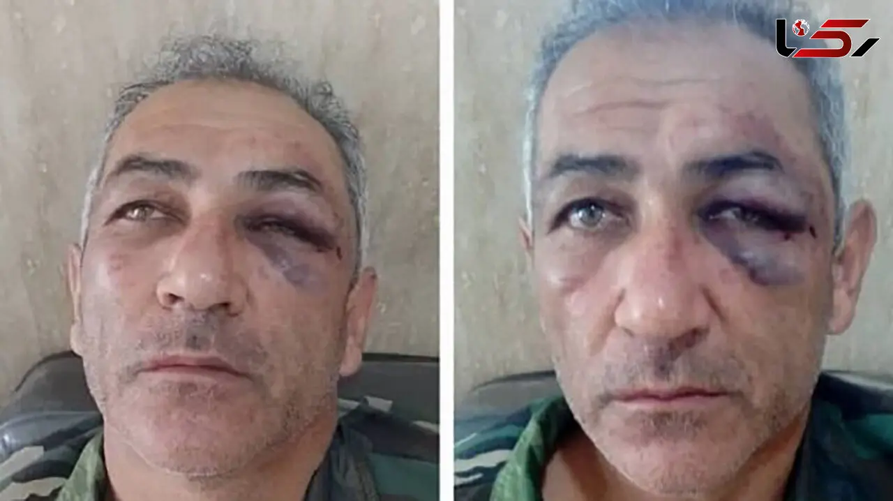 حمله دردناک قاچاقچیان چوب به یک جنگلبان در آستار + عکس