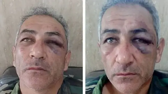 حمله دردناک قاچاقچیان چوب به یک جنگلبان در آستار + عکس