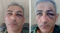 حمله دردناک قاچاقچیان چوب به یک جنگلبان در آستار + عکس