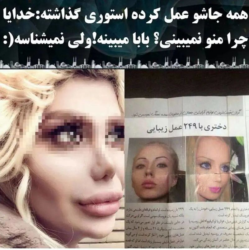 سلطان عمل جراحی