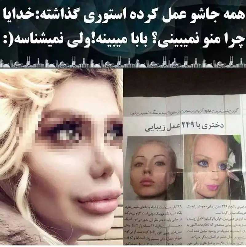 سلطان عمل جراحی