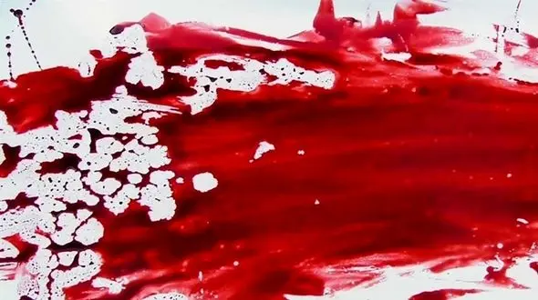 شکافتن قلب جوان 19 ساله با چاقو / جوان رودانی مرد و بعد زنده شد!