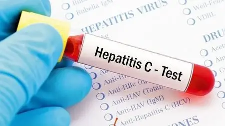 تشخیص سریع هپاتیت C در 15 دقیقه؛ دستاورد بزرگ دانشمندان!