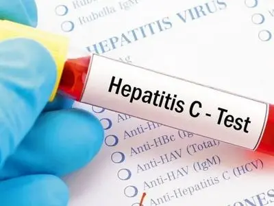 تشخیص سریع هپاتیت C در 15 دقیقه؛ دستاورد بزرگ دانشمندان!