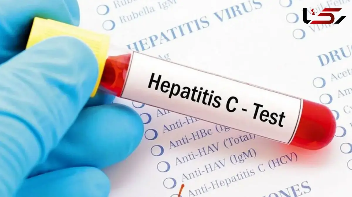 تشخیص سریع هپاتیت C در 15 دقیقه؛ دستاورد بزرگ دانشمندان!